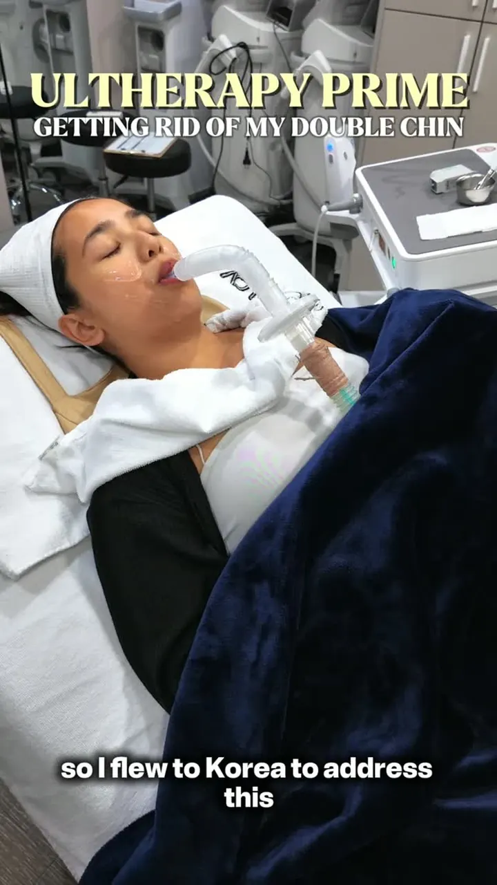 Krisha M. during her Ultherapy Prime session for the area under the chin at VOS Dermatology, Gangnam